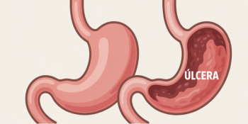 Helicobacter pylori: A Bactéria que Ataca Seu Estômago em Silêncio